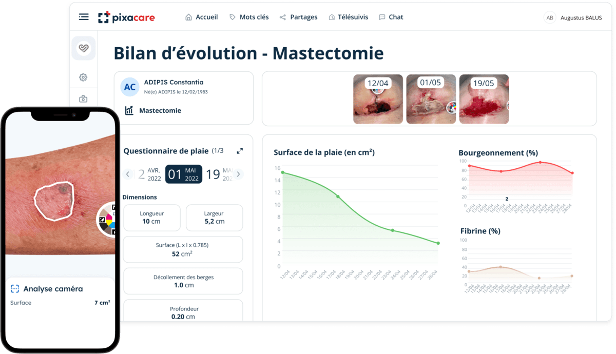 Pixacare séduit les investisseurs et lève 3 M€ pour son suivi IA