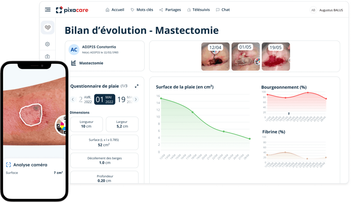 Pixacare lève 3 millions d’euros pour révolutionner le suivi des plaies chroniques