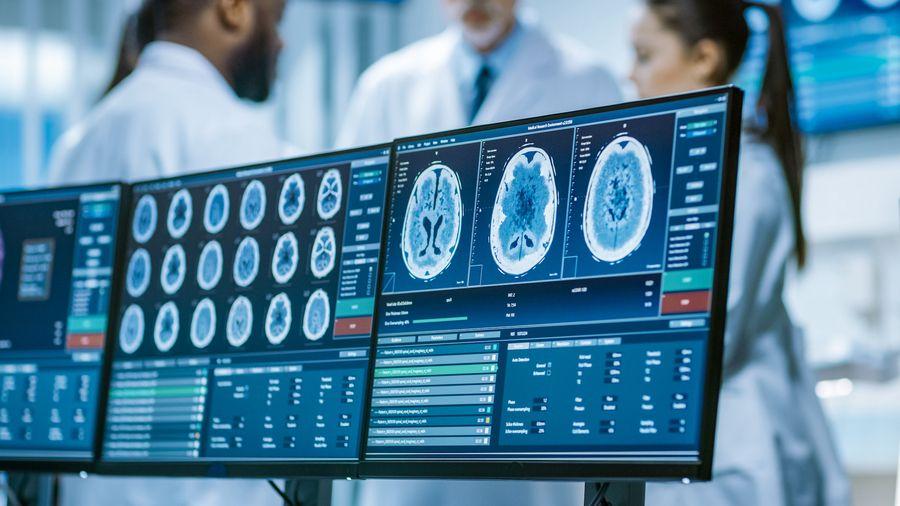 Acticor Biotech : nouvel essai du glenzocimab sur l'infarctus du myocarde 