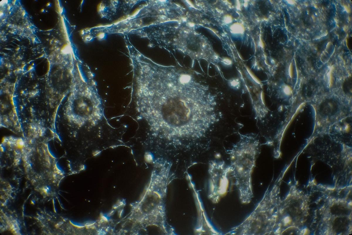 Oncovita lève 8 millions d’euros pour développer son vaccin immuno-thérapeutique contre le cancer