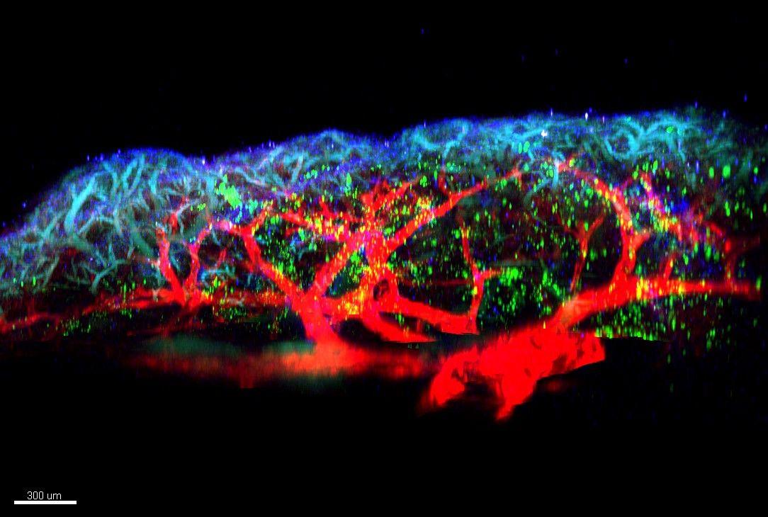 Une molécule identifiée comme élément déclencheur de l’inflammation dans les allergies respiratoires