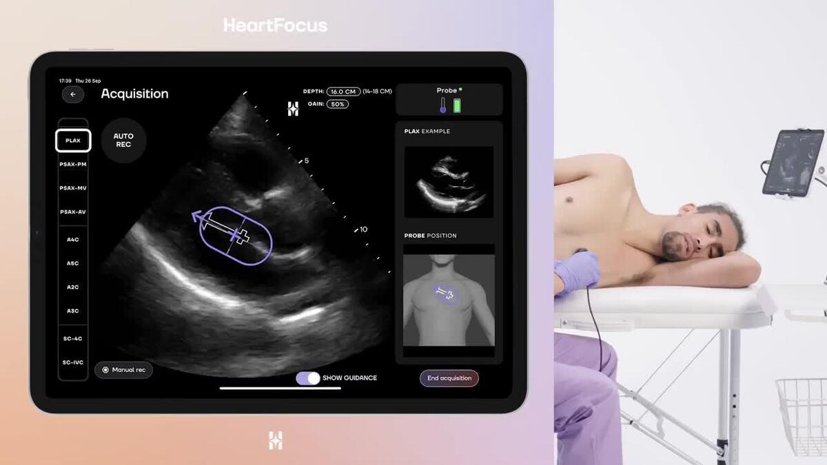 DESKi lève 6 millions de dollars pour révolutionner l’échocardiographie