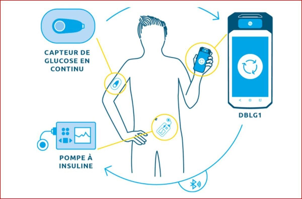 Diabeloop, spécialiste de l’IA thérapeutique, lève 15 millions d’euros