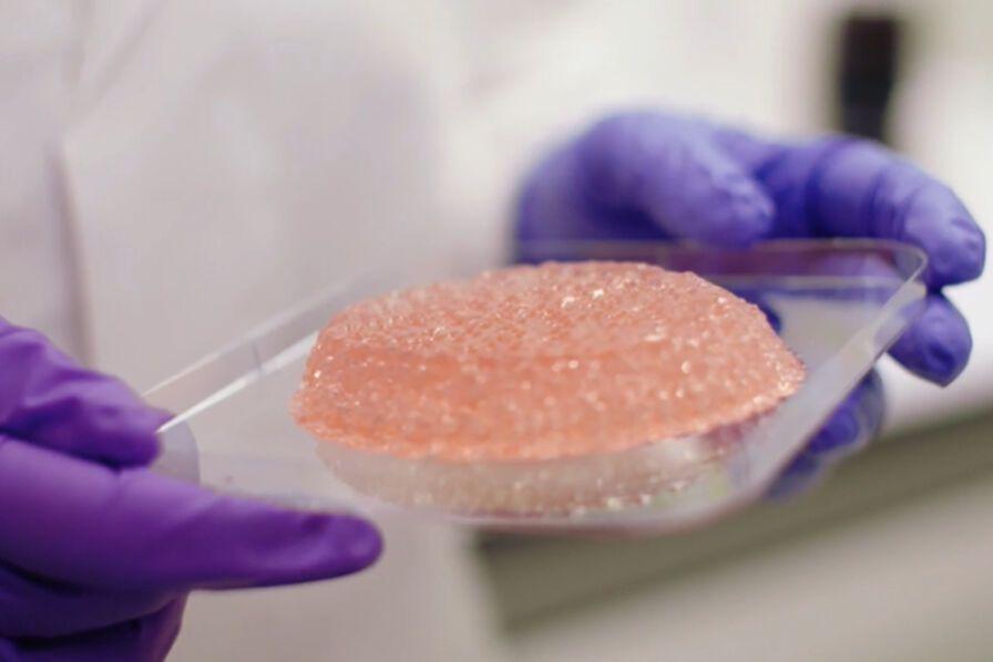 Healshape développe des solutions naturelles pour la reconstruction mammaire